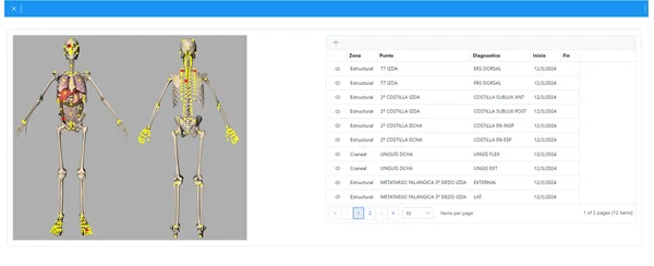 Captura de pantalla de la interfaz del software iFisia, mostrando un modelo anatómico 3D con puntos de diagnóstico y un listado de tratamientos y zonas del cuerpo